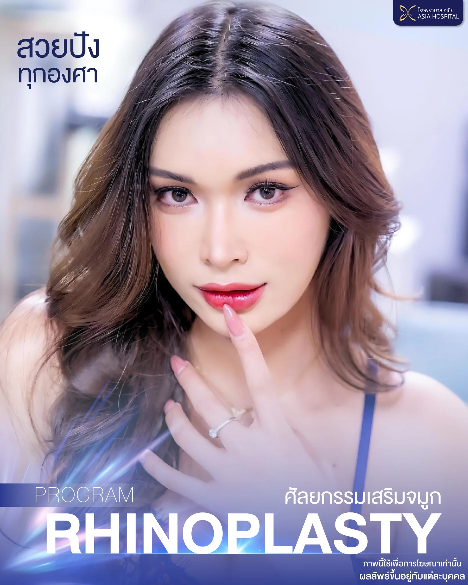 review-rhinoplasty-nose-surgery-01 → โรงพยาบาลเอเซีย รีวิวเสริมจมูก-ศัลยกรรมจมูก-โรงพยาบาลเอเซียศัลยกรรมตกแต่ง