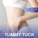 tummy-tuck-review | โรงพยาบาลเอเซีย ดึงหน้า