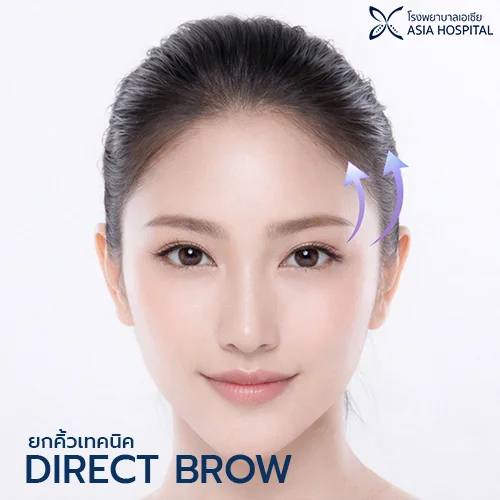ยกคิ้ว Direct Brow Lift | โรงพยาบาลเอเซีย | โรงพยาบาลเอเซีย ยกคิ้ว direct brow