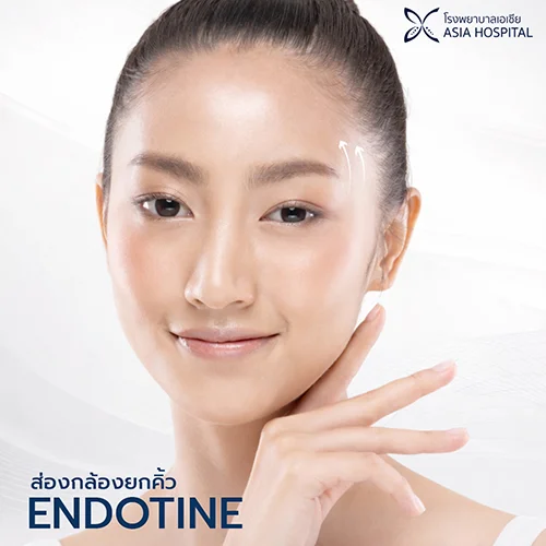 ยกคิ้ว Endotine | โรงพยาบาลเอเซีย | โรงพยาบาลเอเซีย ส่องกล้องยกคิ้ว