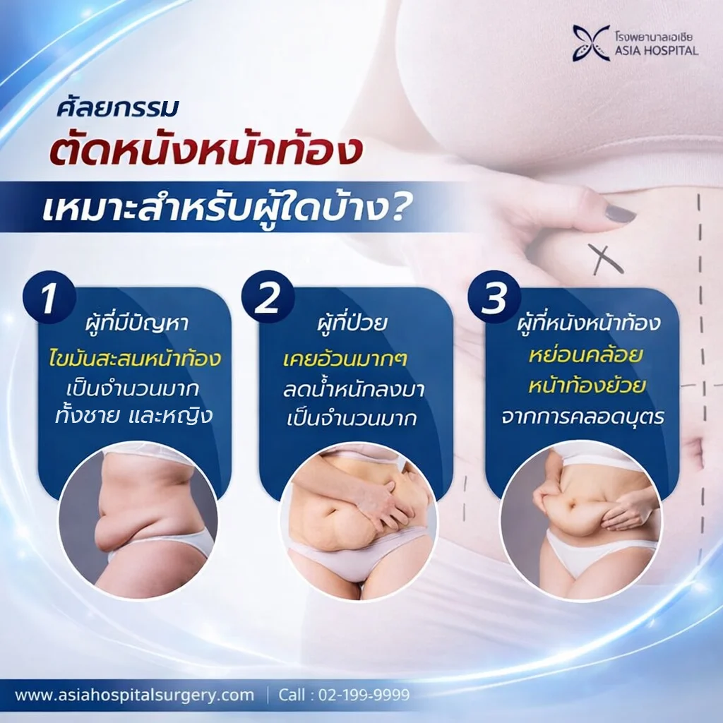 ศัลยกรรมตัดหนังหน้าท้อง