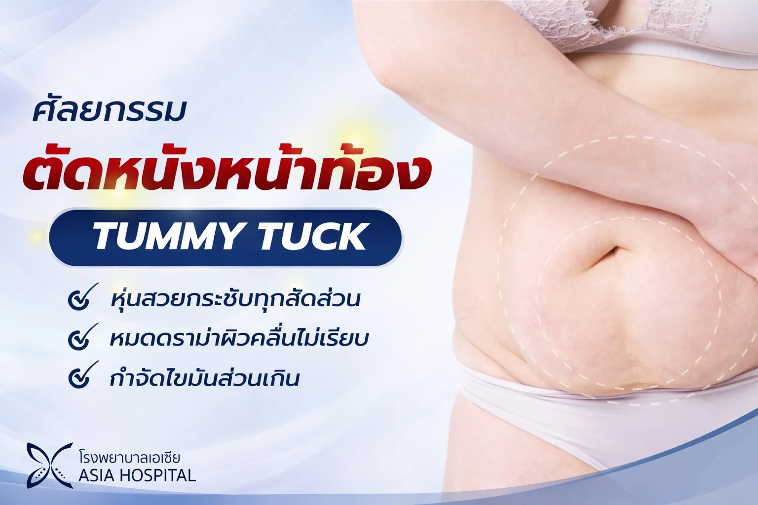 ตัดหนังหน้าท้อง Tummy Tuck