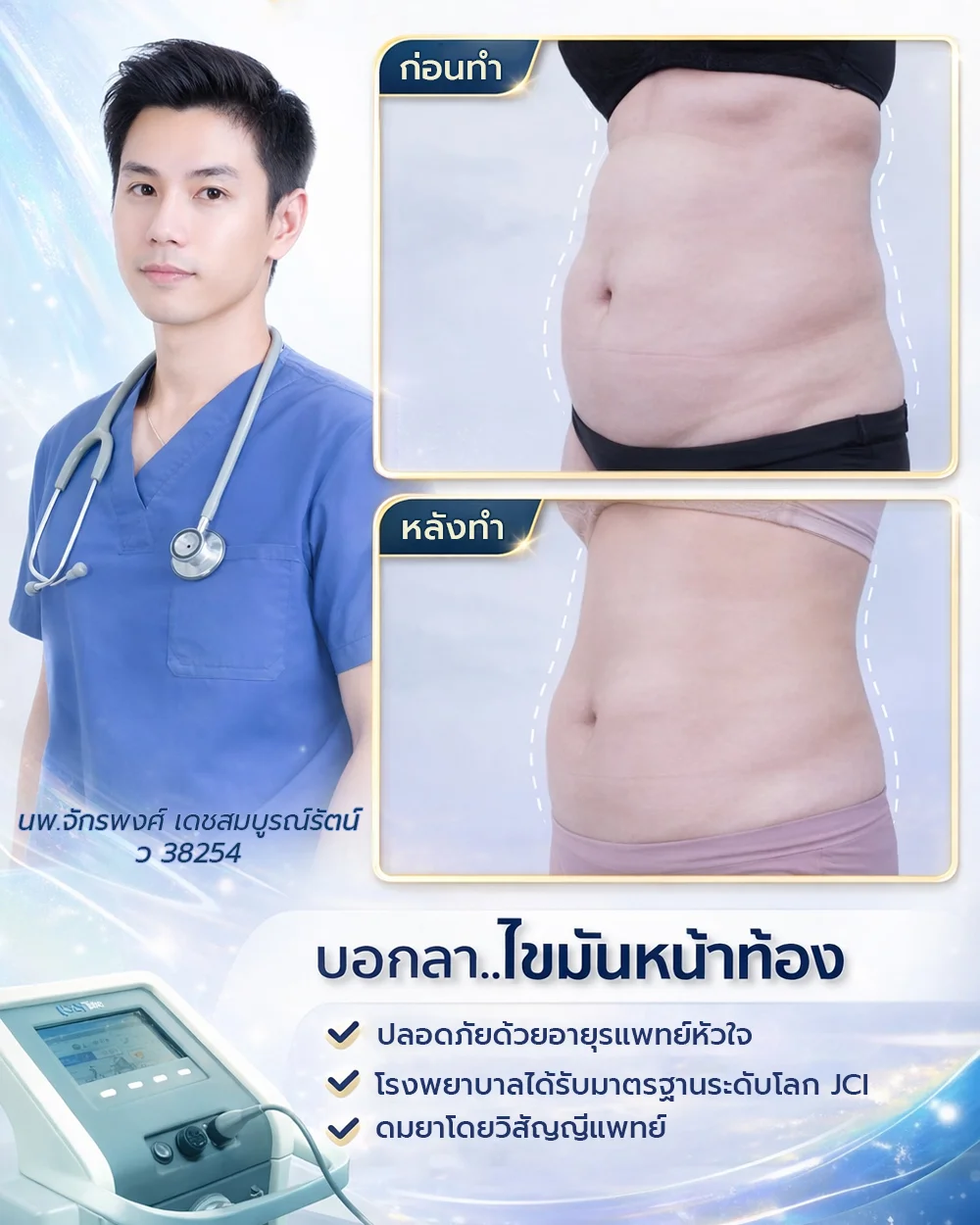 รีวิวดูดไขมัน_ดูดไขมันหน้าอก