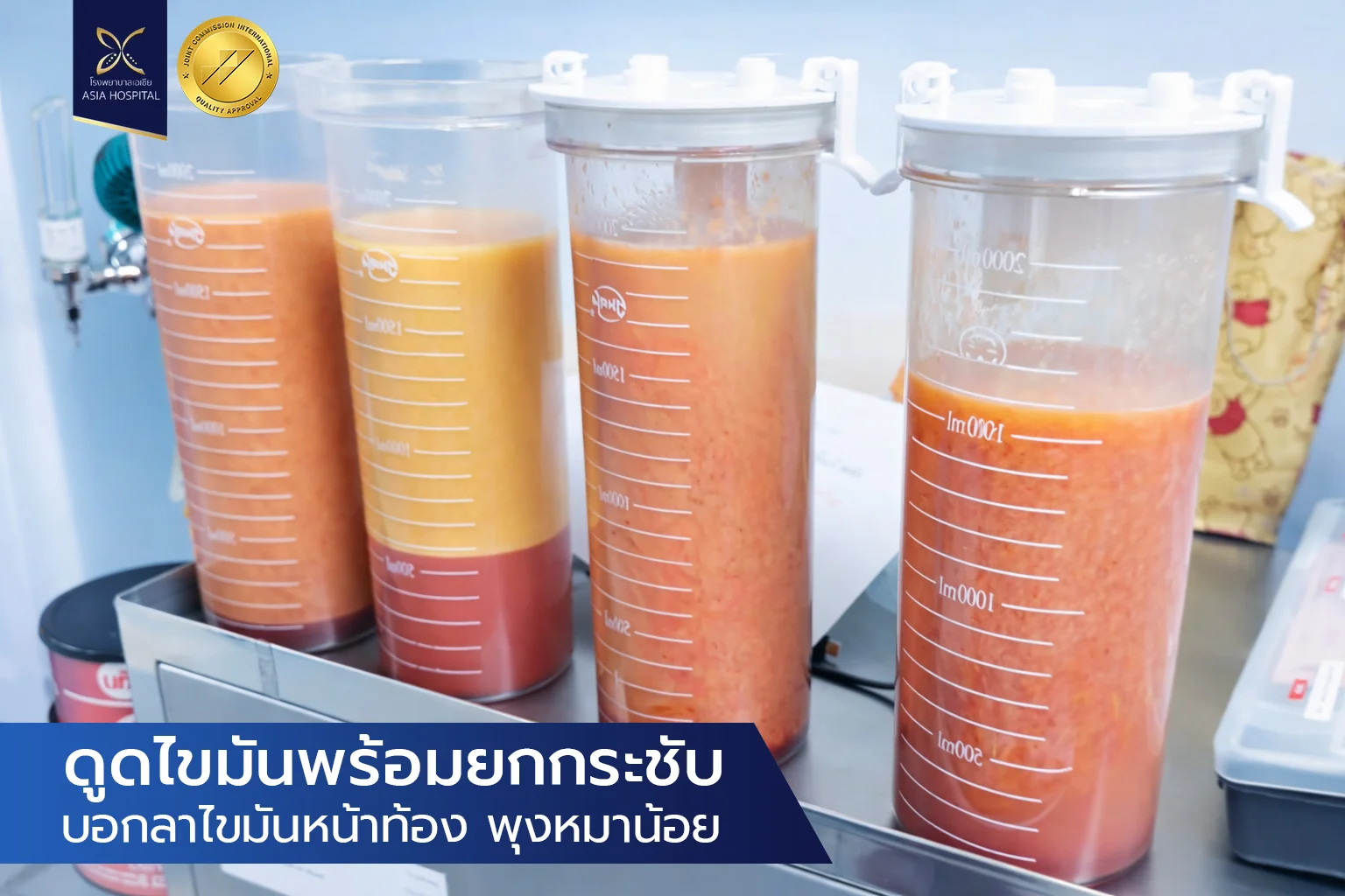 ศัลยกรรมดูดไขมัน