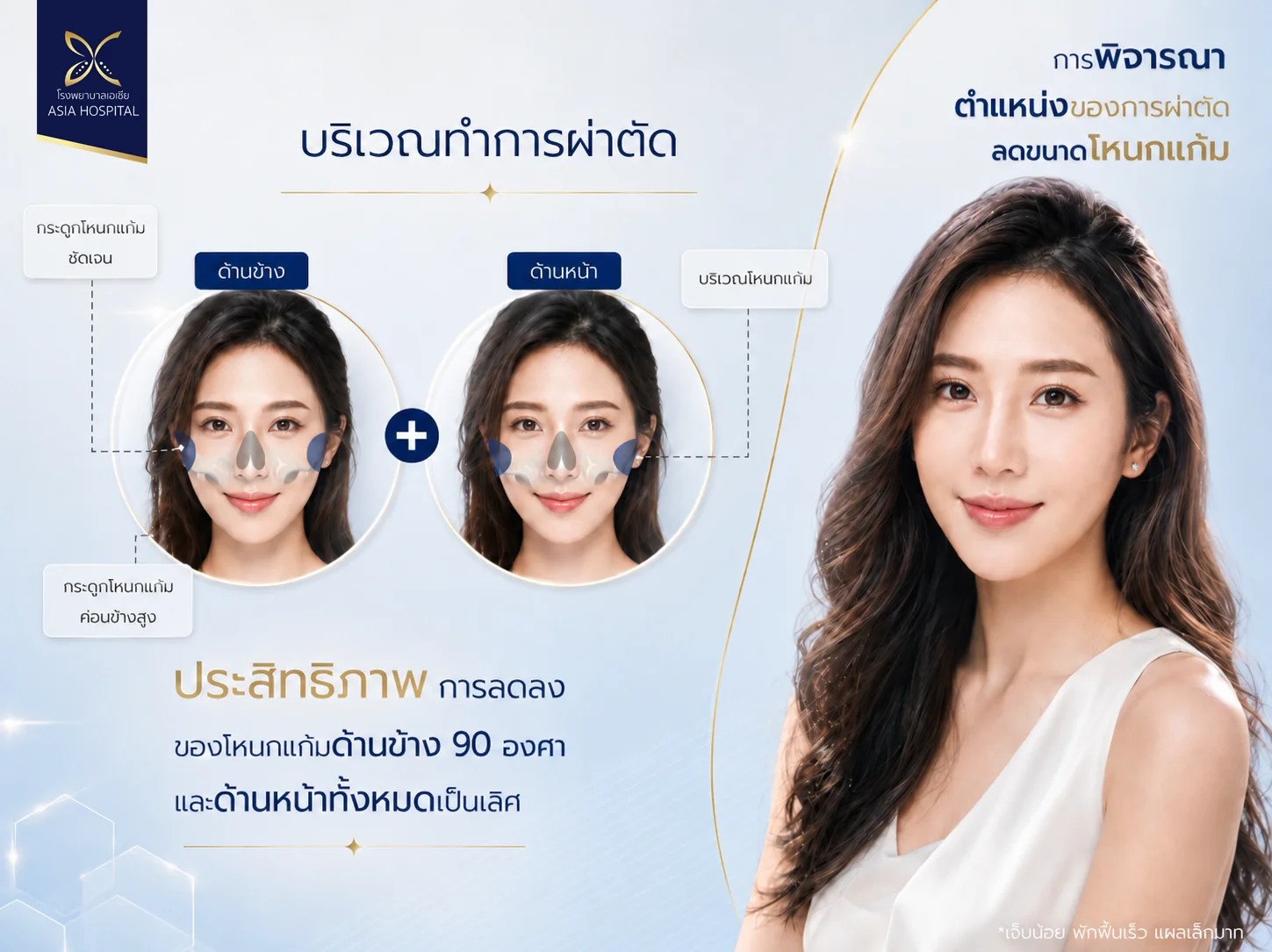 ลดโหนกแก้ม-ยุบโหนกแก้ม