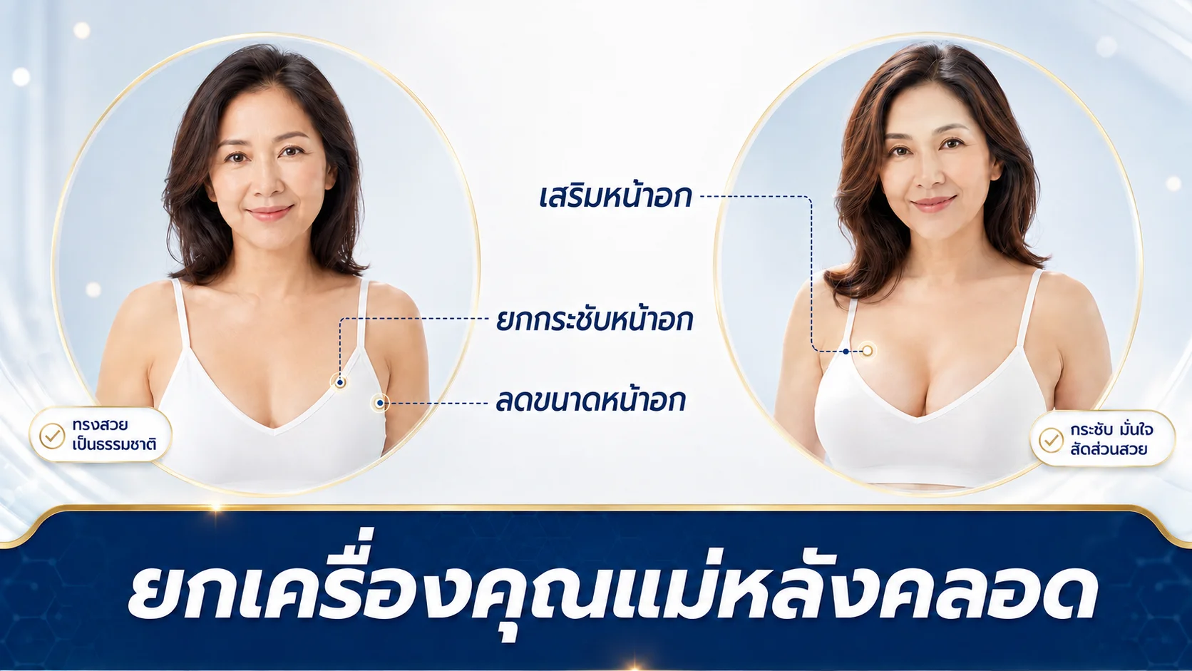 ศัลยกรรมคุณแม่หลังคลอด Mommy Makeover