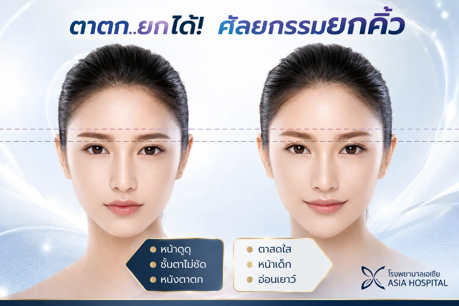 ศัลยกรรมยกคิ้ว Brow Lift Surgery | โรงพยาบาลเอเซีย | โรงพยาบาลเอเซีย ศัลยกรรมยกคิ้ว