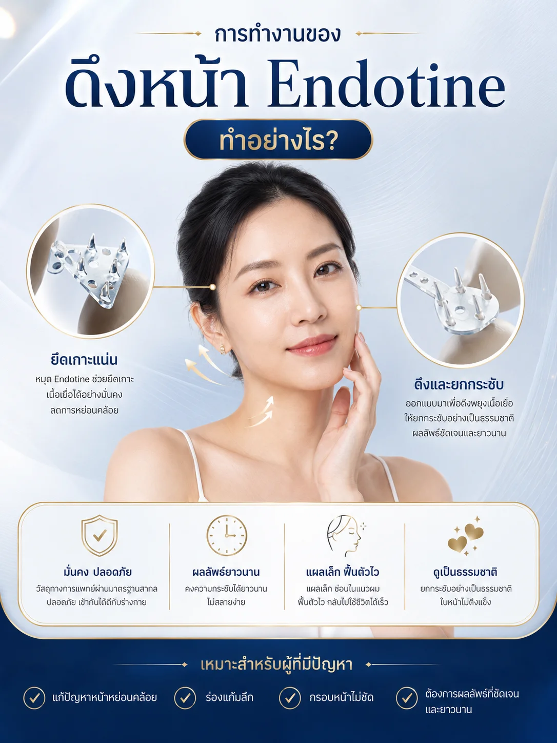 ดึงหน้าเอนโดไทน์-Endotine