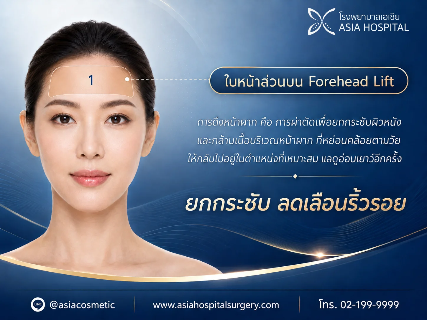 ศัลยกรรมดึงหน้าผาก | โรงพยาบาลเอเซีย | โรงพยาบาลเอเซีย ศัลยกรรมดึงหน้าผาก