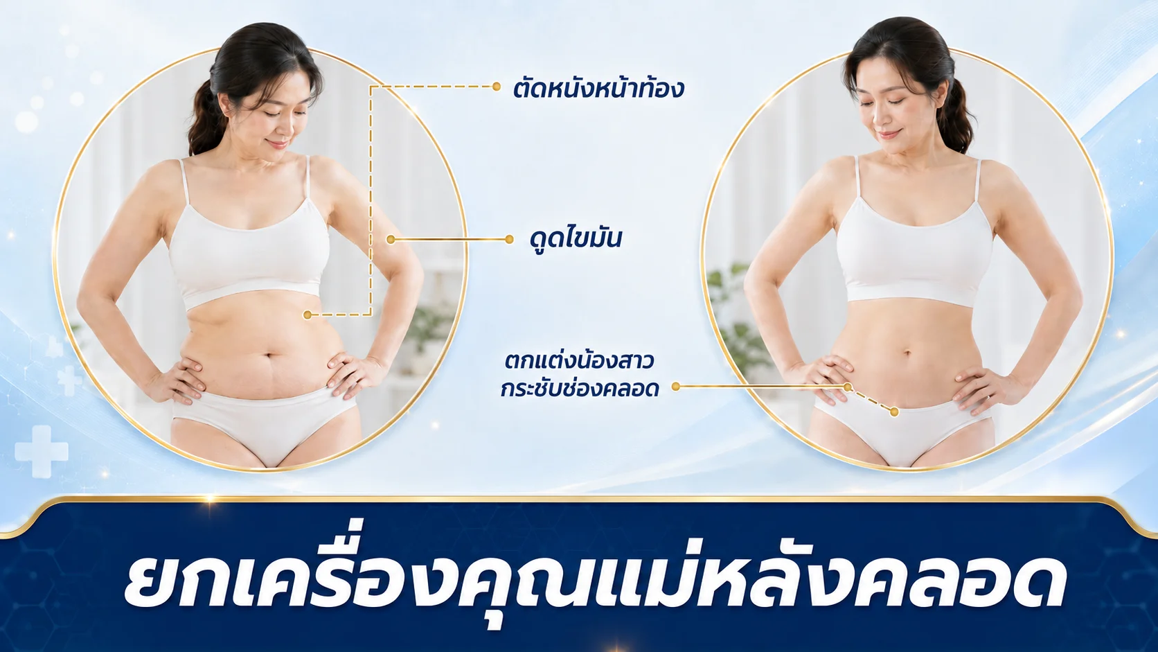 ศัลยกรรมคุณแม่หลังคลอด ตัดหน้าท้องท้อง และจุดซ่อนเร้น