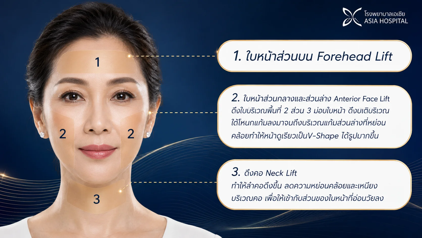 ศัลยกรรมดึงหน้า