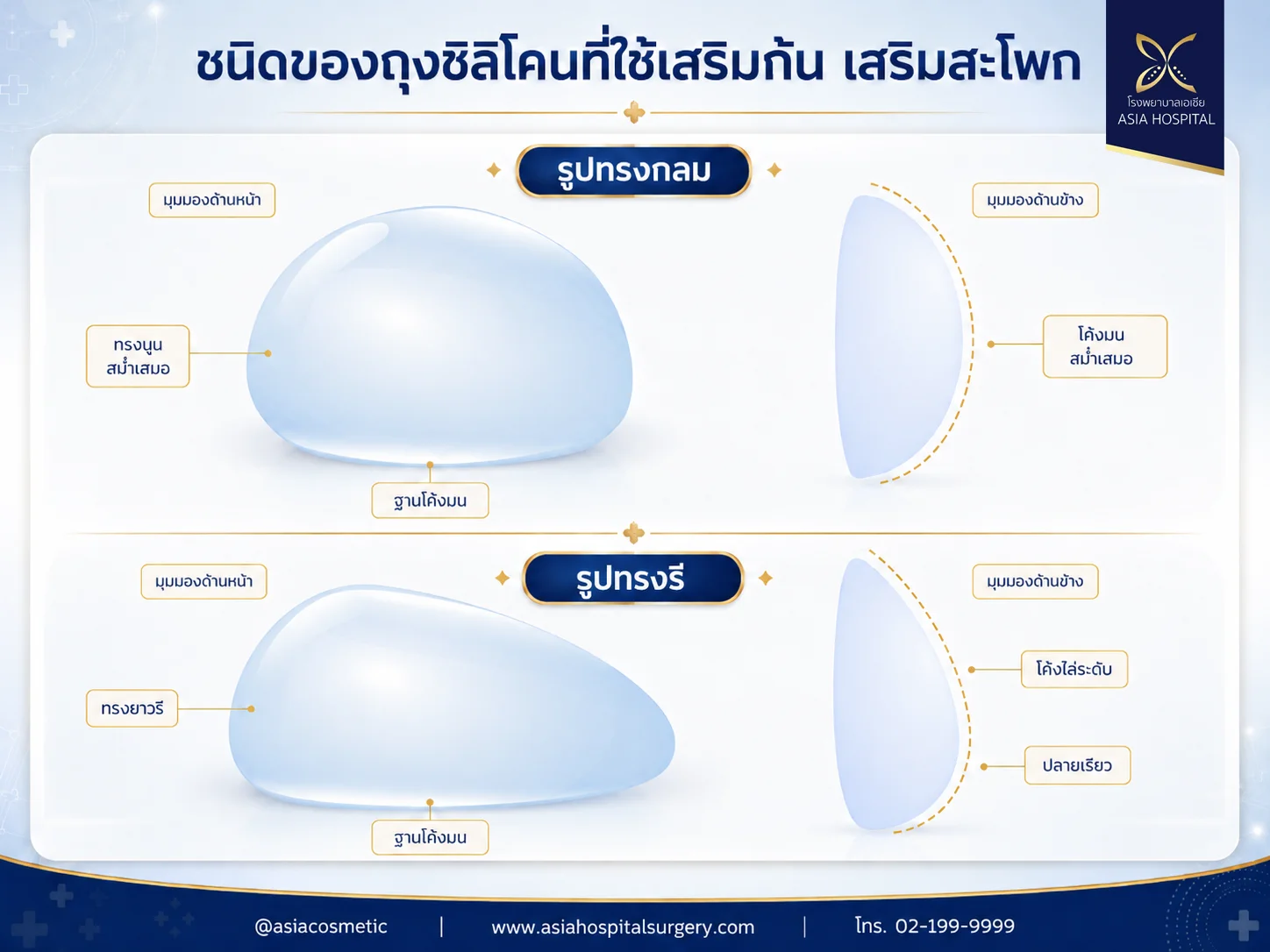 ซิลิโคนเสริมสะโพก