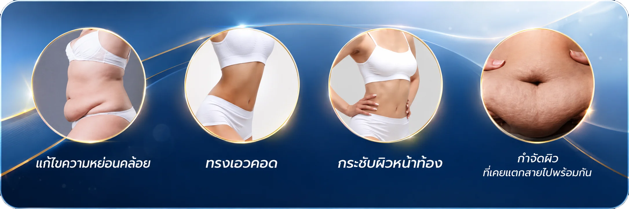 ตัดหนังหน้าท้อง