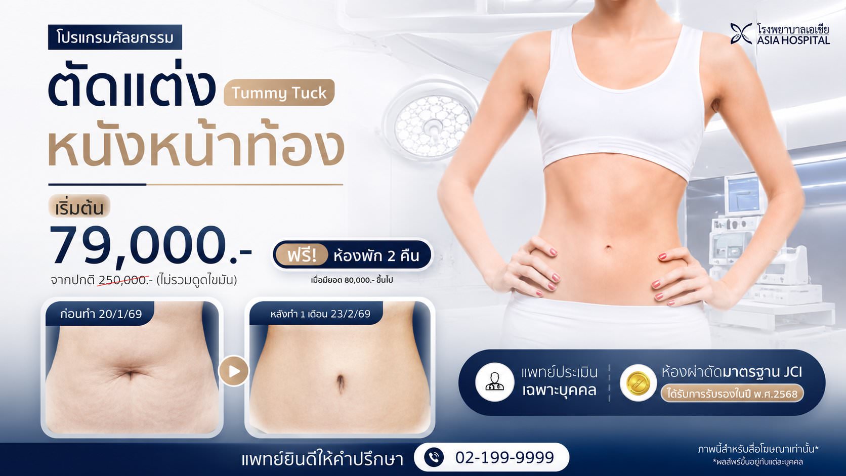 ศัลยกรรมตัดหนังหน้าท้อง