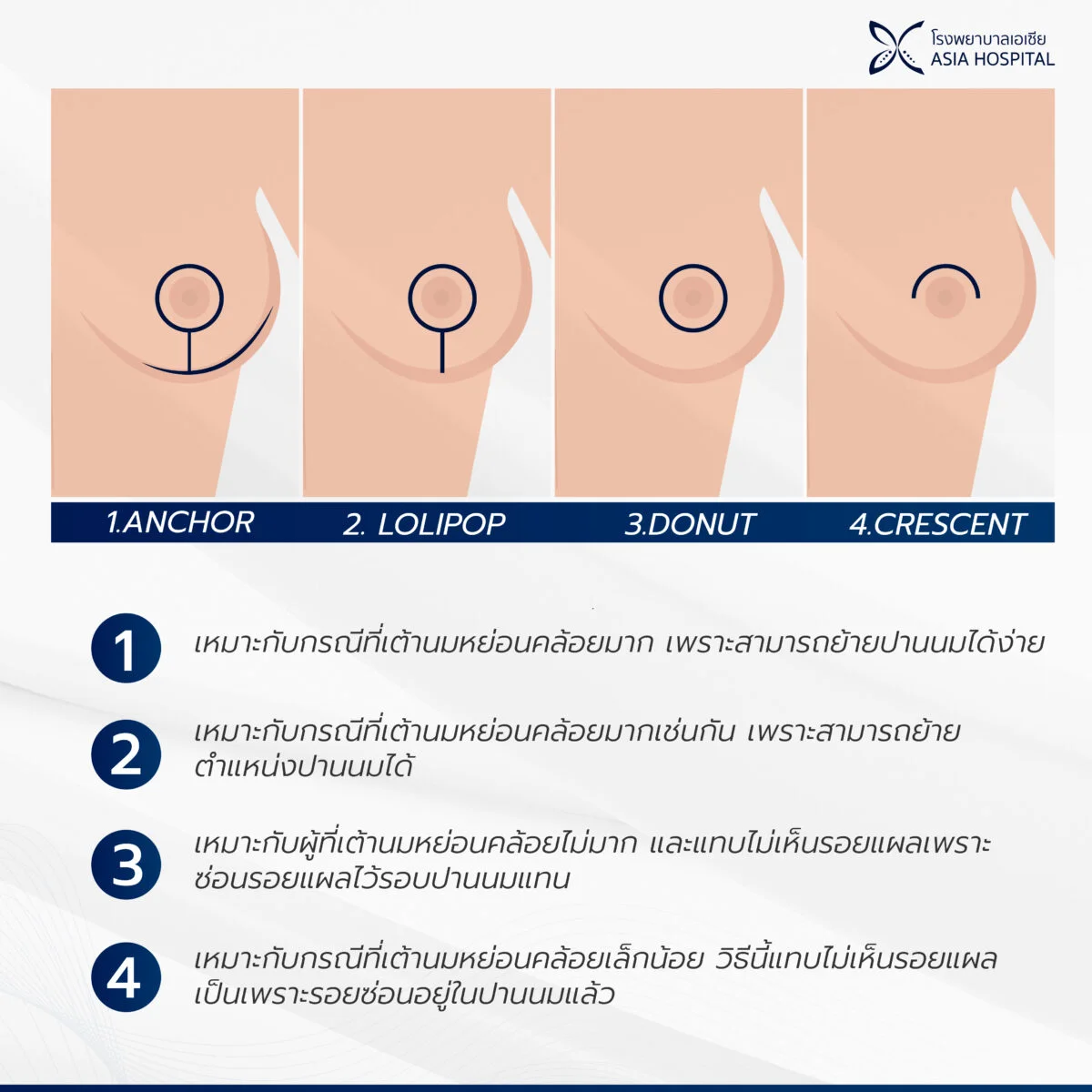 เทคนิค-ยกกระชับหน้าอก