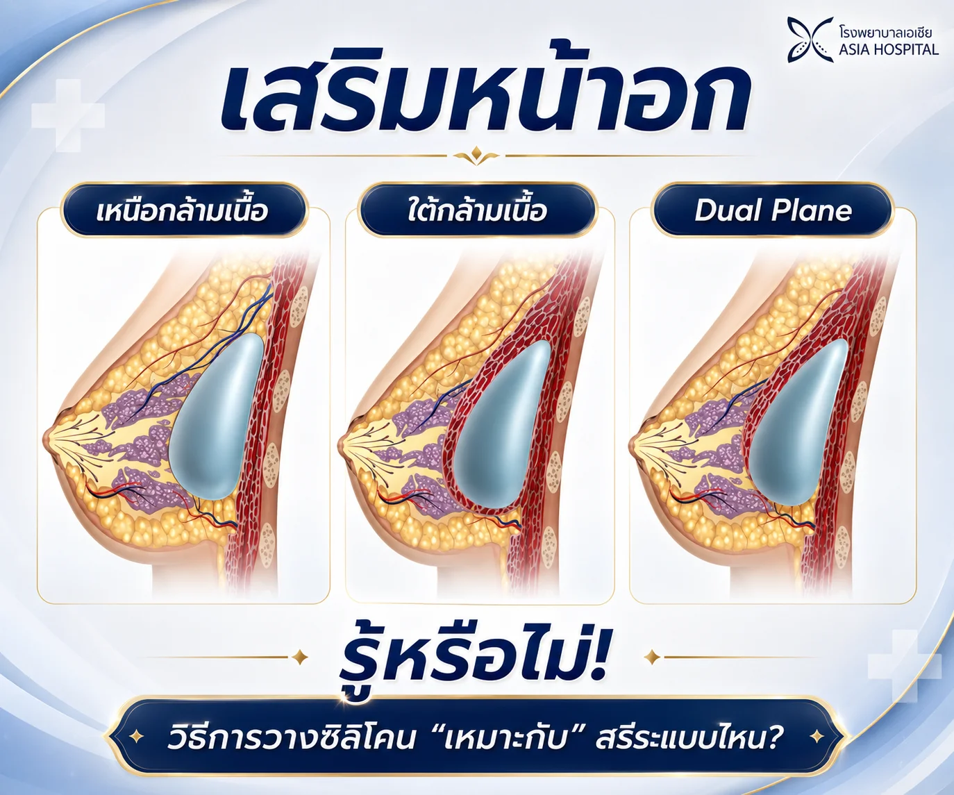 ตำแหน่งซิลิโคนเสริมหน้าอก