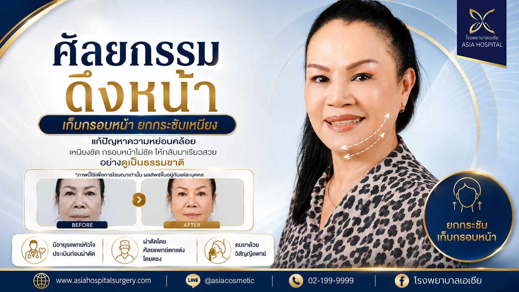 ศัลยกรรมดึงหน้า-ดึงหน้า