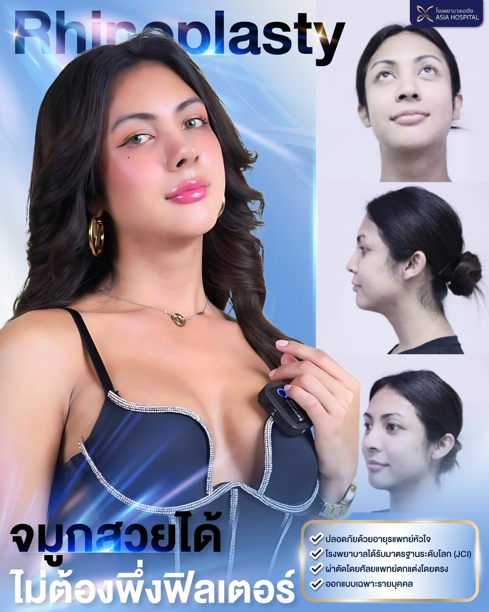 รีวิวเสริมจมูก | โรงพยาบาลเอเซีย | โรงพยาบาลเอเซีย รีวิวเสริมจมูก-จมูกสวยมาก