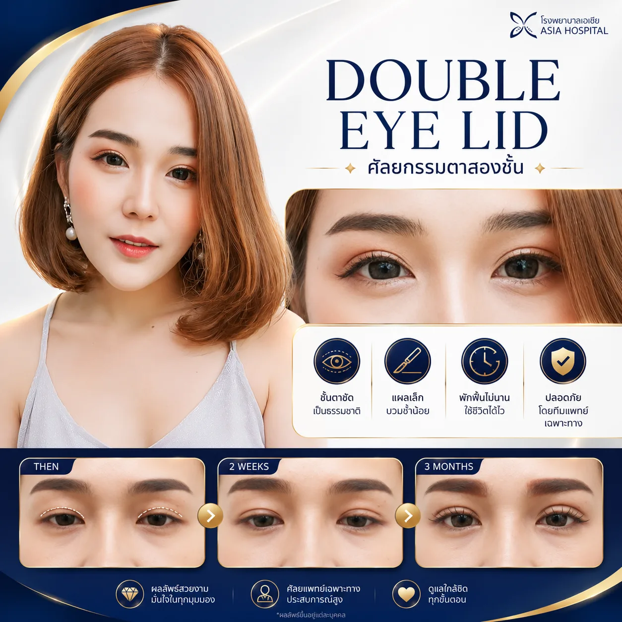 ทำตาสองชั้น-รีวิวทำตาสองชั้น