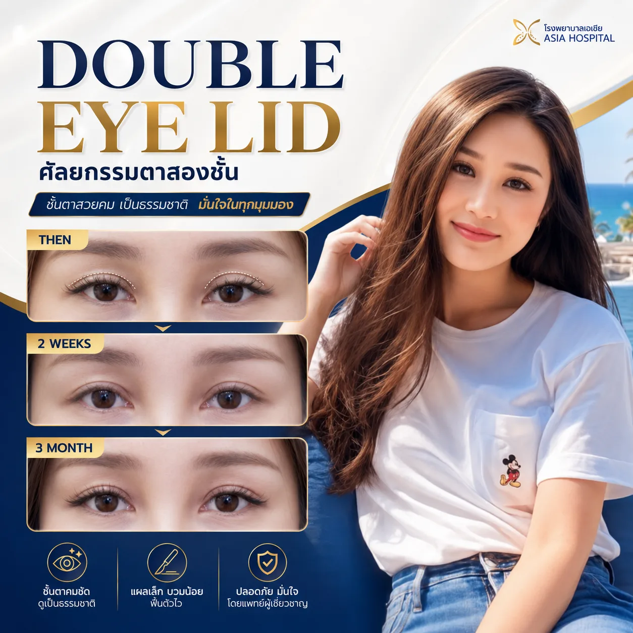 รีวิตาสองชั้น-ทำตาสองชั้น