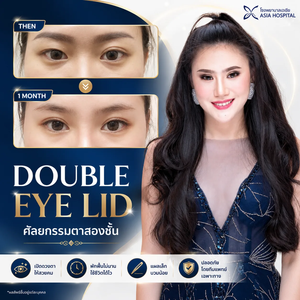 รีวิตาสองชั้น-ทำตาสองชั้น