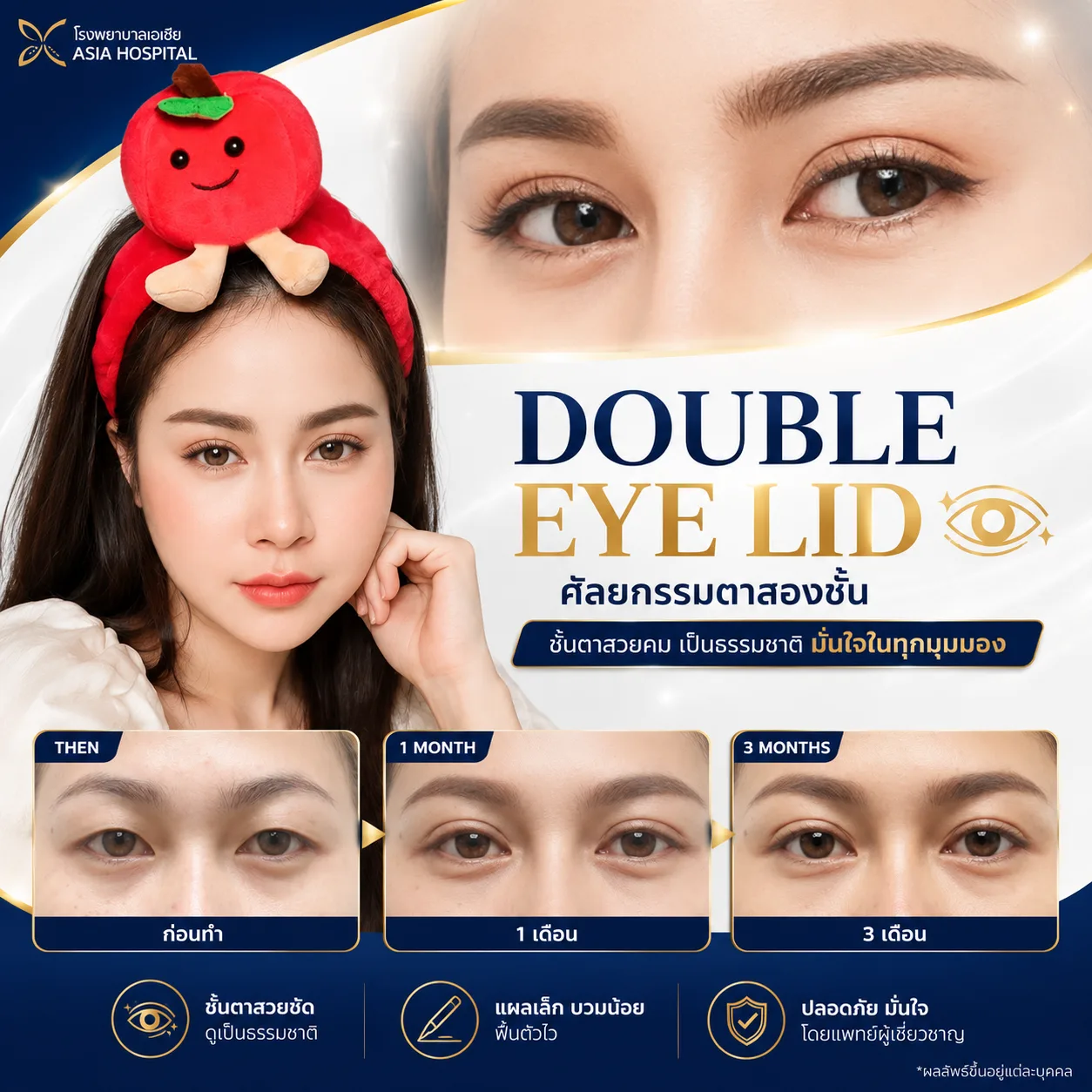 รีวิวทำตาสองชั้น-ทำตาสองชั้นราคาเท่าไหร่