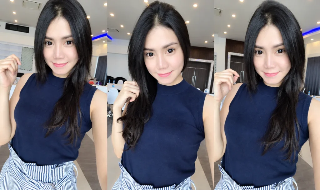 หลังทำ ปรับโครงหน้า ยุบโหนกแก้ม ตัดกราม วีไลน์