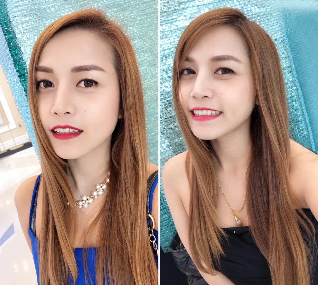 ก่อนทำ มีปัญหาหน้าเอียง