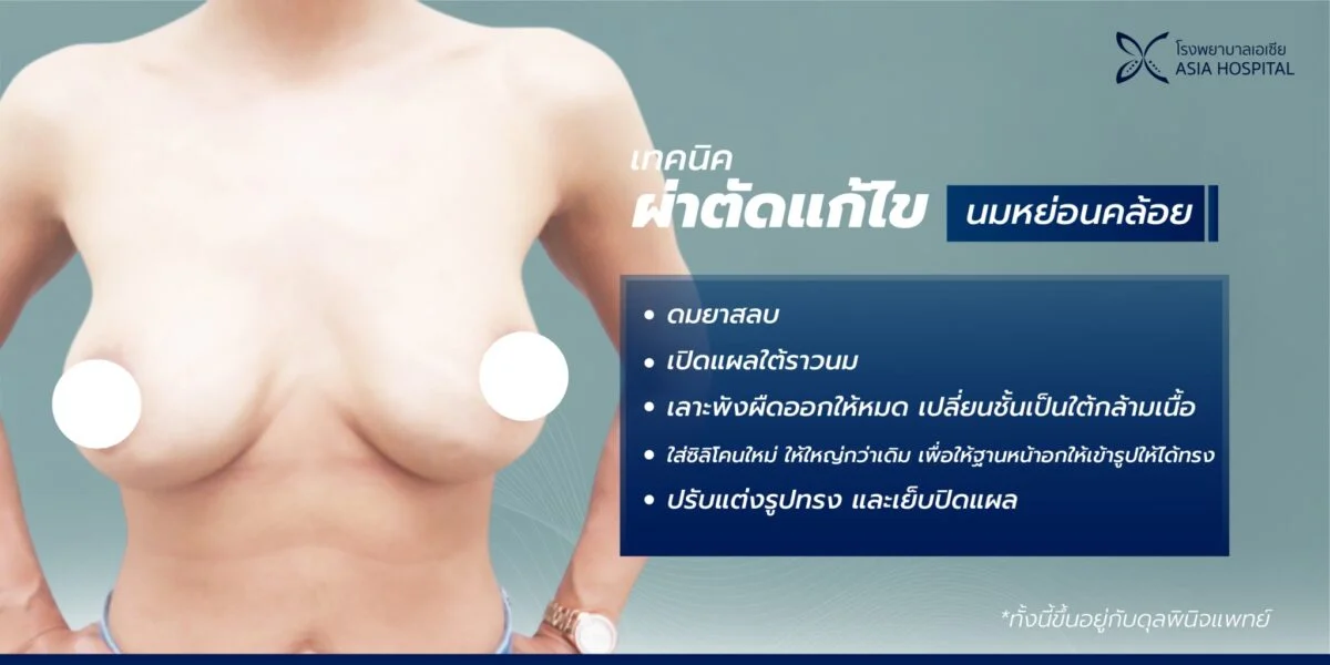 แก้หน้าอก นมหย่อนคล้อย | โรงพยาบาลเอเซีย | โรงพยาบาลเอเซีย แก้หน้าอก-นมหย่อนคล้อย-แก้ไขหน้าอก