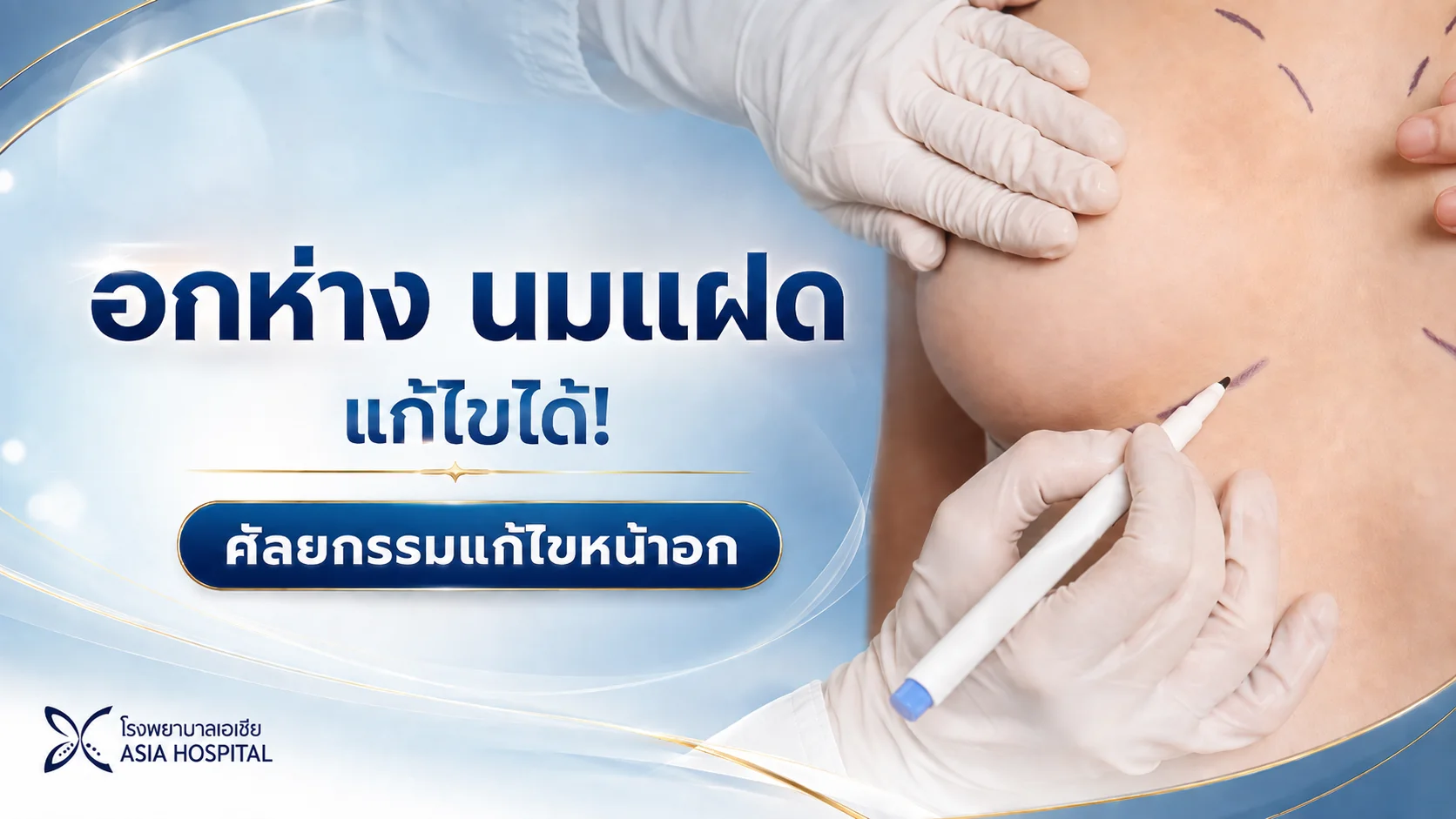 แก้หน้าอก อกห่าง นมแฝด | โรงพยาบาลเอเซีย | โรงพยาบาลเอเซีย แก้หน้าอก-ที่ไหนดี-แก้ไขหน้าอก
