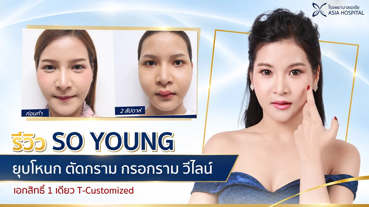 รีวิวยุบโหนกแก้ม-ตัดกราม