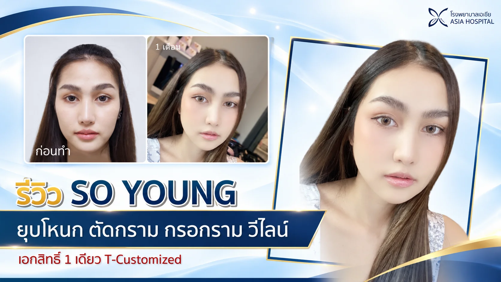 ยุบโหนกแก้ม-ลดโหนกแก้ม-ปรับโครงหน้า