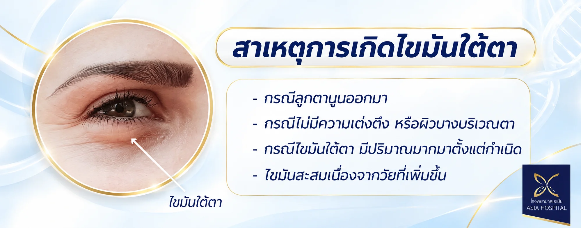 ถุงใต้ตาเกิดจากอะไร