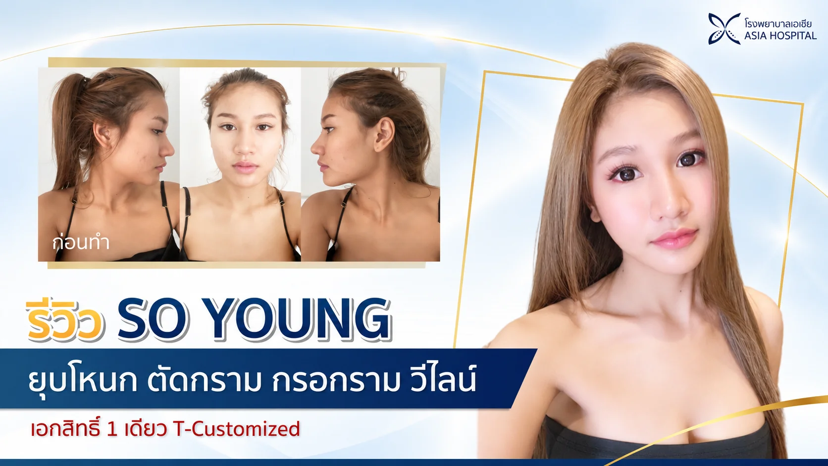 รีวิวยุบโหนกแก้ม-ตัดกราม-วีไลน์