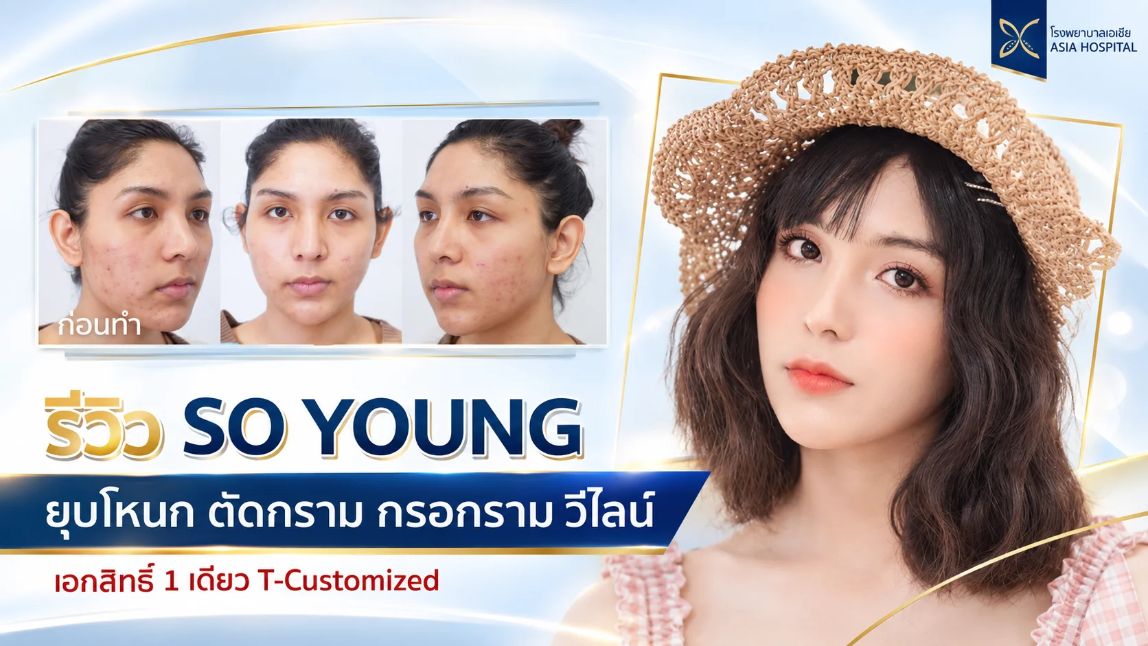 รีวิวปรับโครงหน้า-ยุบโหนกแก้ม-ตัดกราม-วีไลน์