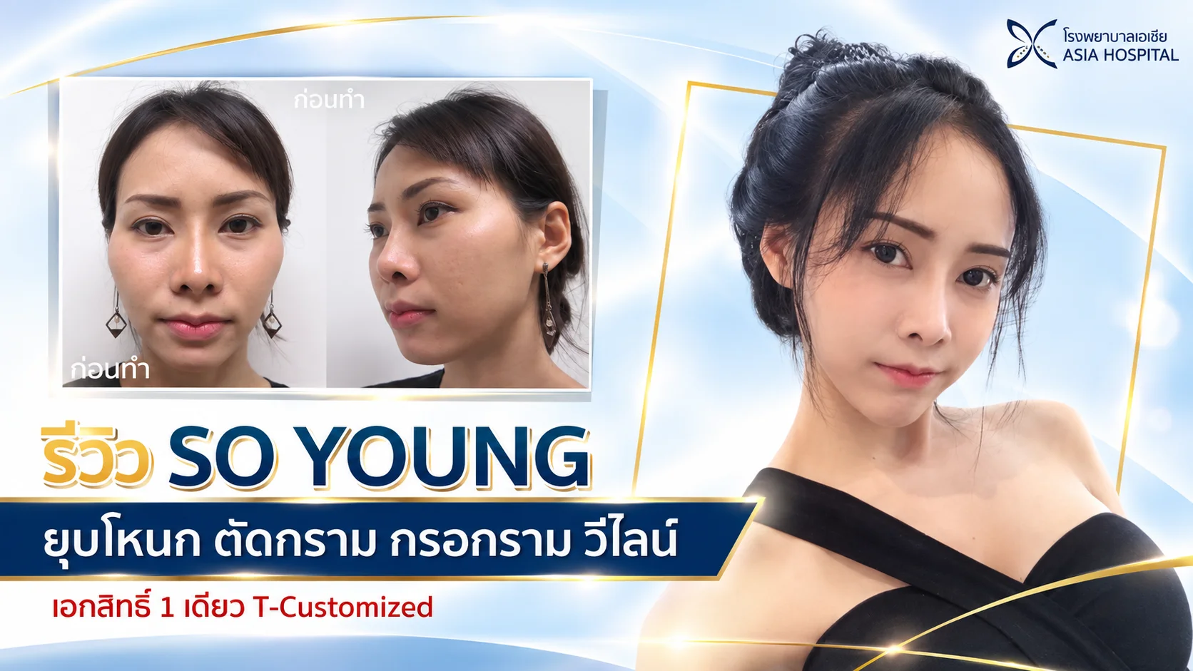 ยุบโหนกแก้ม-หน้าเรียวสวย-ลดโหนกแก้ม