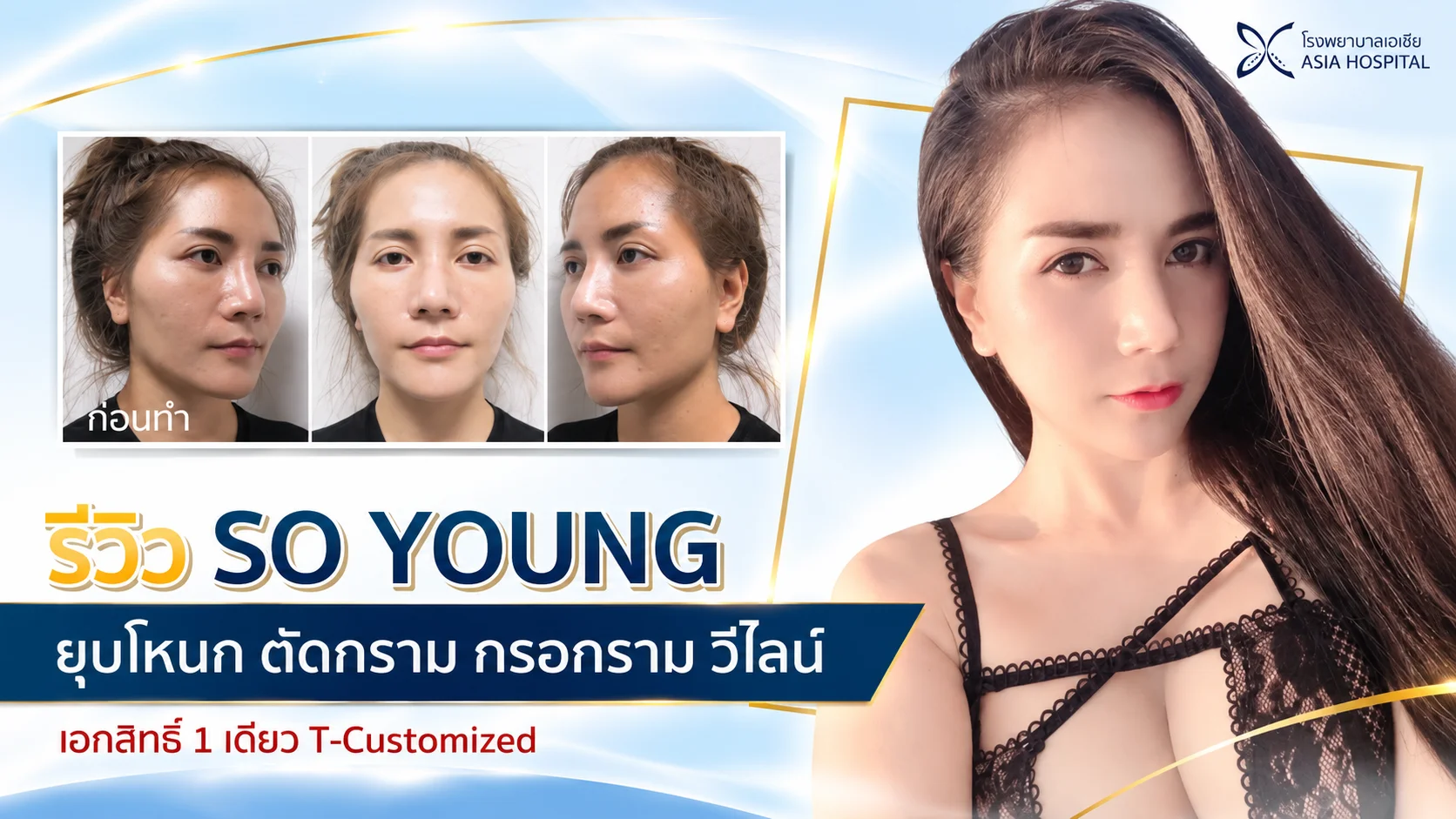 ยุบโหนกแก้ม-ตัดกราม-กรอกราม-วีไลน์