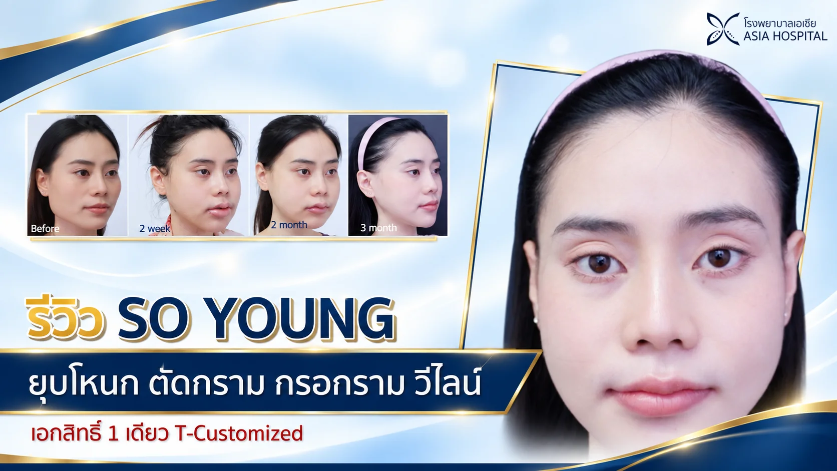 ยุบโหนก ตัดกราม กรอกราม แก้ไขคางเล็ก