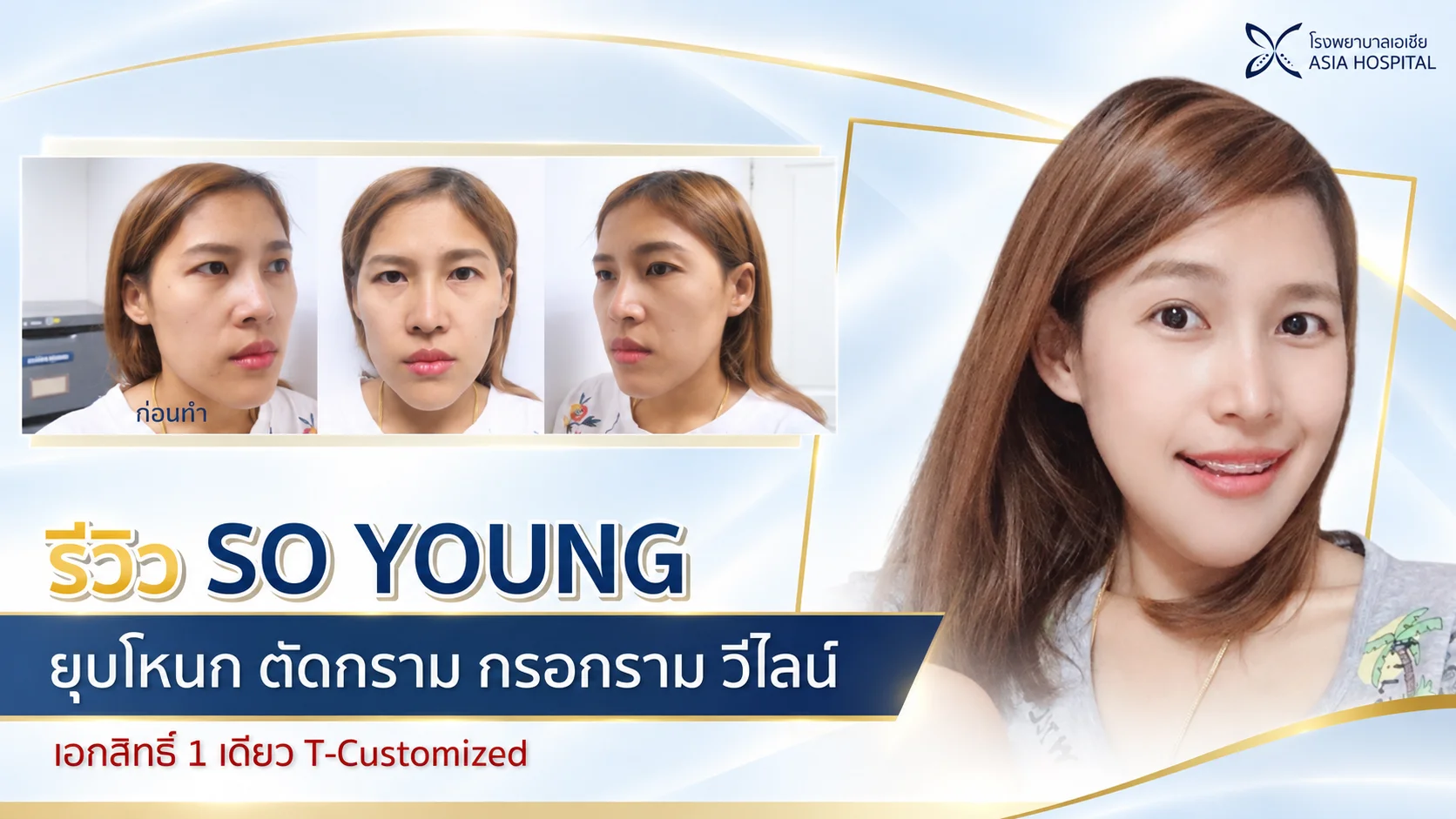 ปรับโครงหน้า ยุบโหนก ตัดกราม