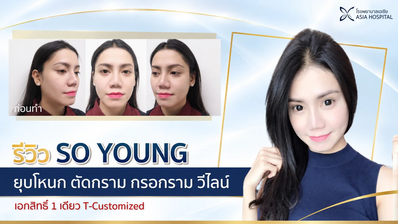 รีวิวยุบโหนกแก้มตัดกราม