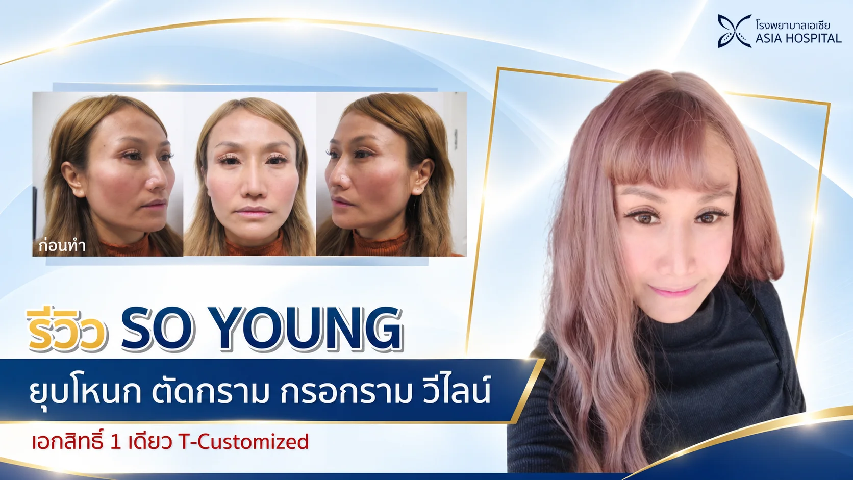 ศัลยกรรมยุบโหนกตัดกราม กรอกราม