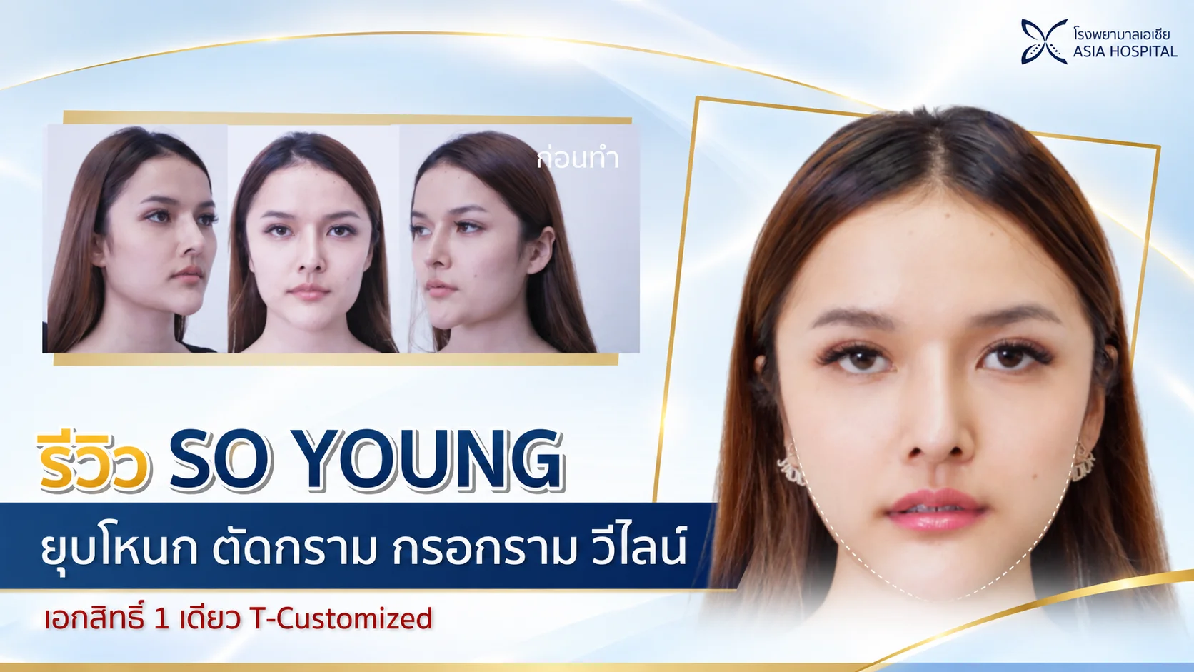 ศัลยกรรมตัดกราม กรอกราม