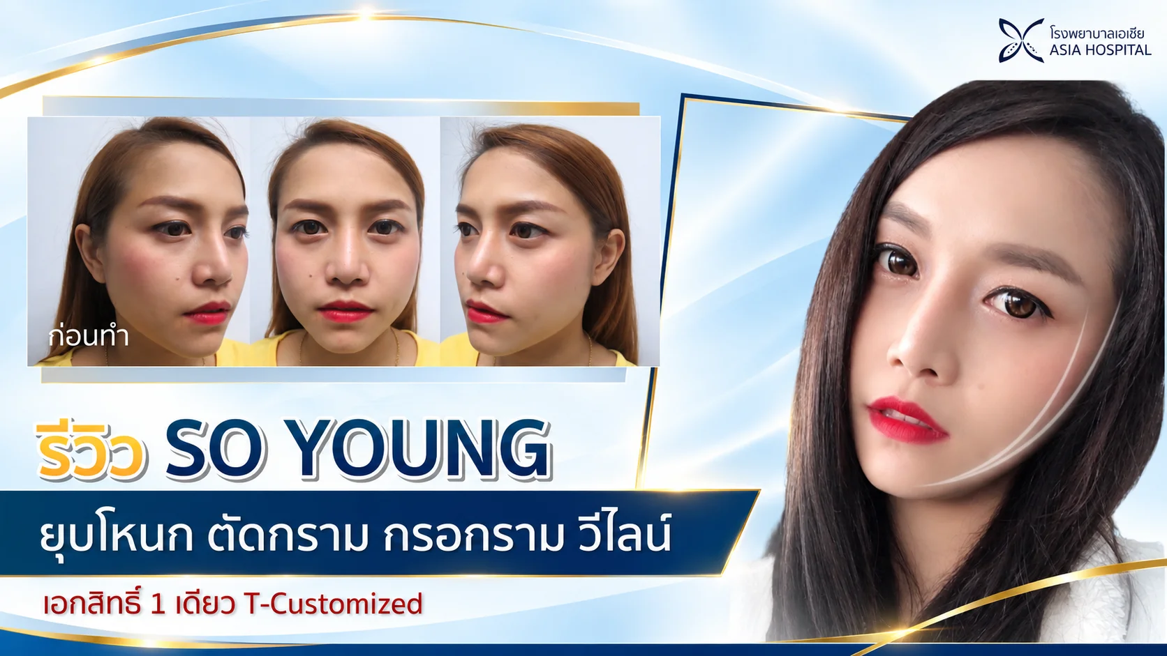 ปรับโครงหน้า ยุบโหนกแก้ม ตัดกราม กรอกราม วีไลน์