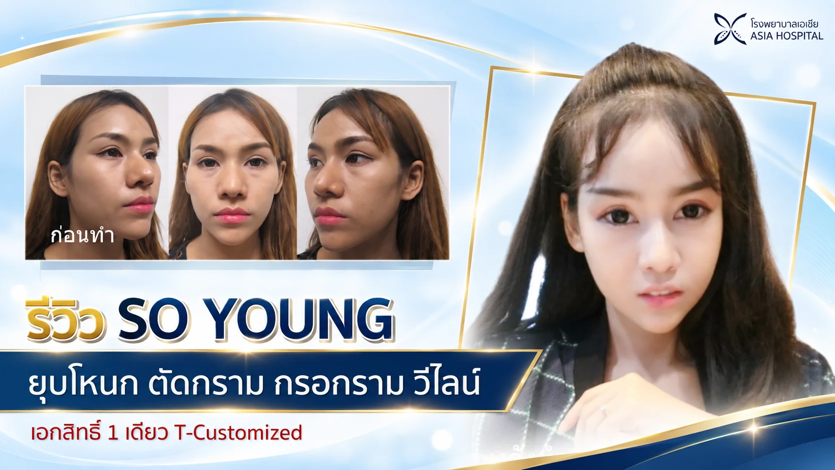 ศัลยกรรมลดโหนกแก้ม ปรับโครงหน้า ยุบโหนกแก้ม