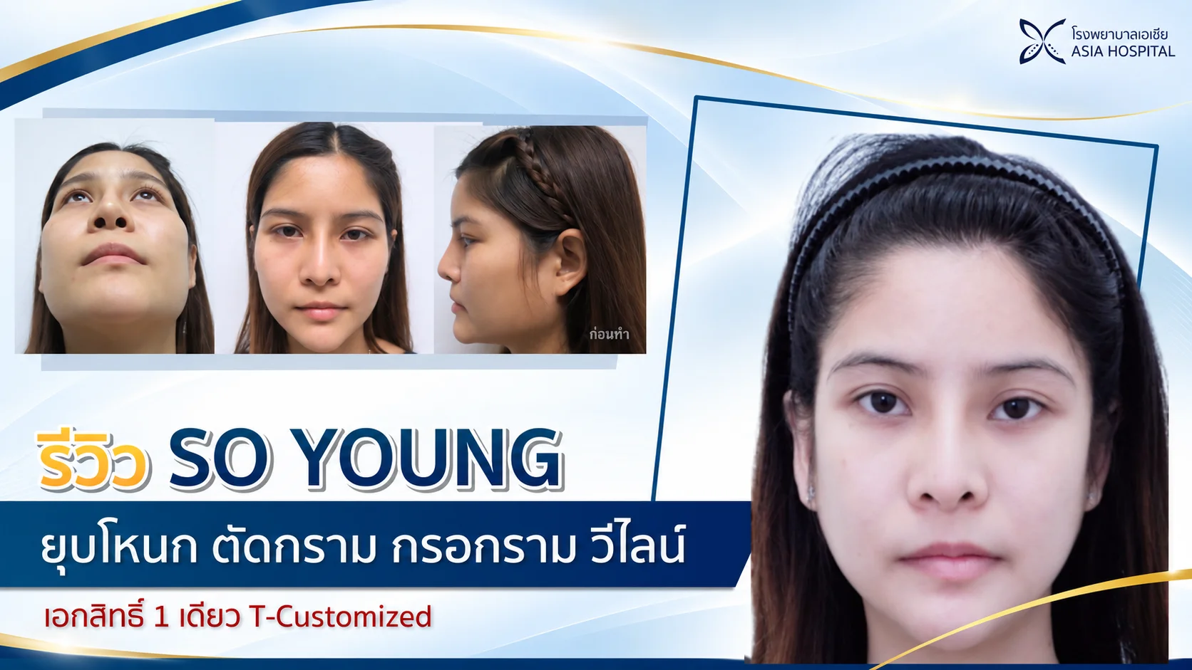ปรับโครงหน้า แก้โหนกแก้มสูง ตัดกราม