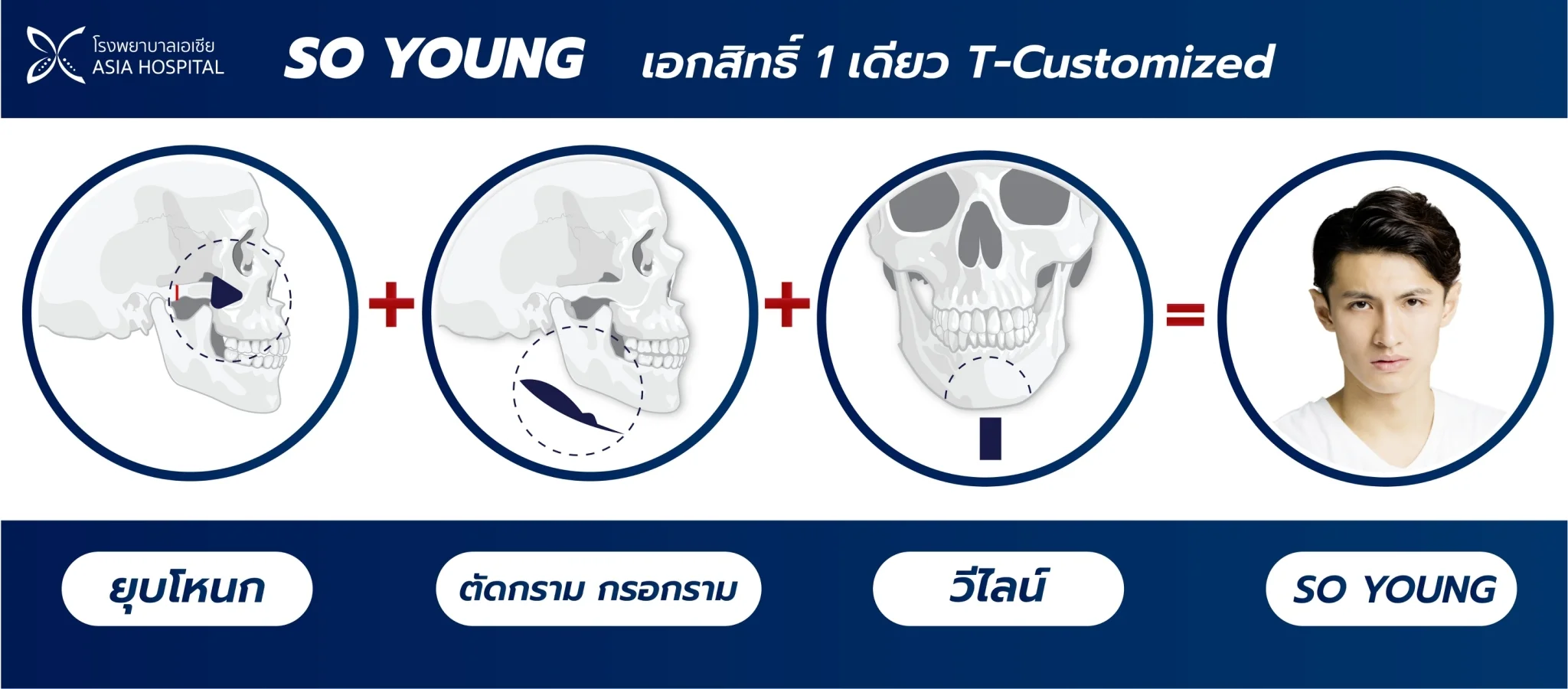 ปรับโครงหน้า ยุบโหนกแก้มผู้ชาย