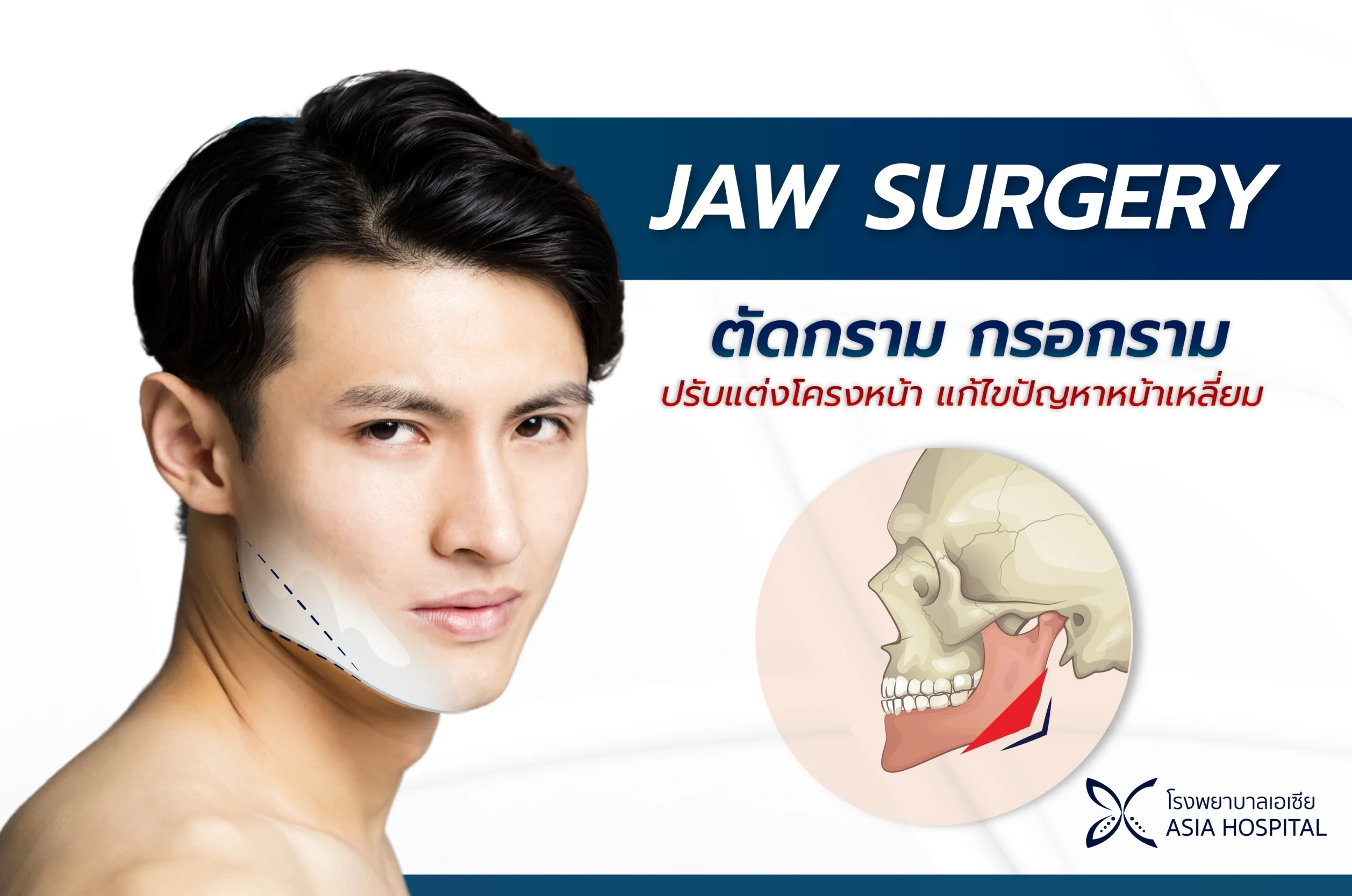 ตัดกราม-กรอกรามผู้ชาย ปรับแต่งโครงหน้า