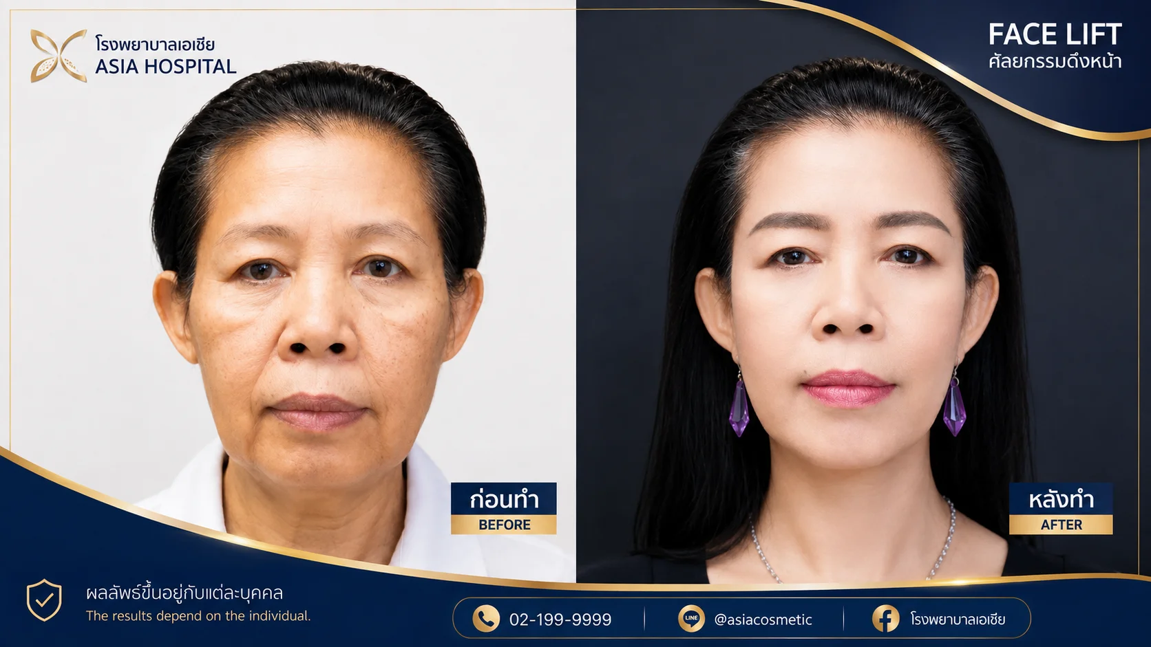 รีวิวดึงหน้าส่วนกลาง