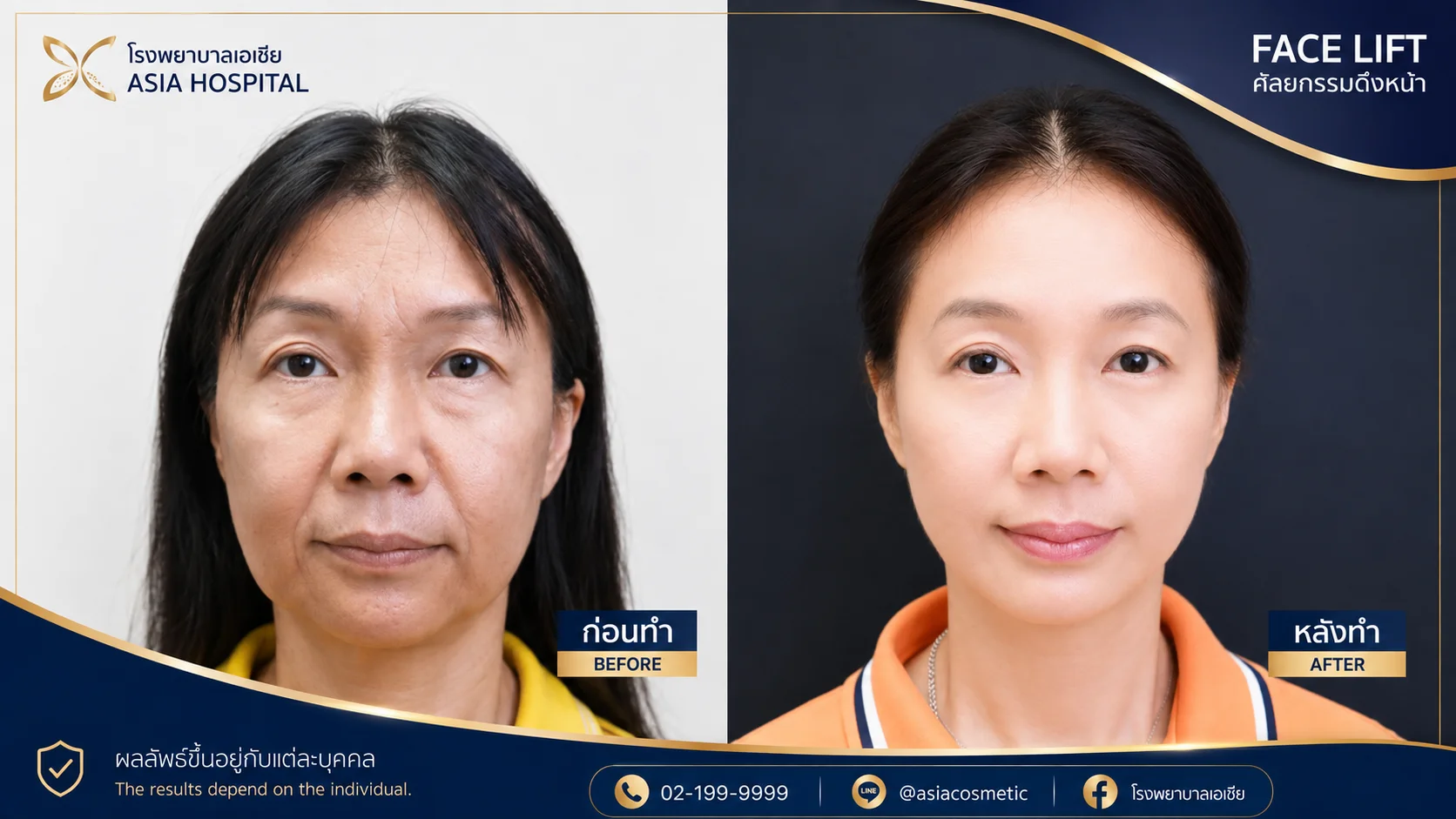 รีวิวดึงหน้าส่วนกลาง