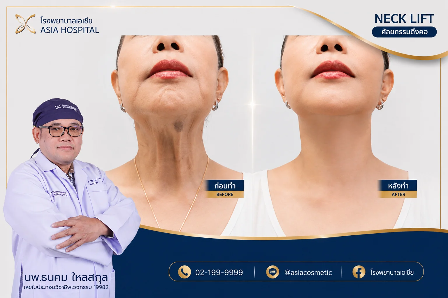 รีวิวศัลยกรรมดึงคอ_รีวิวดึงคอ